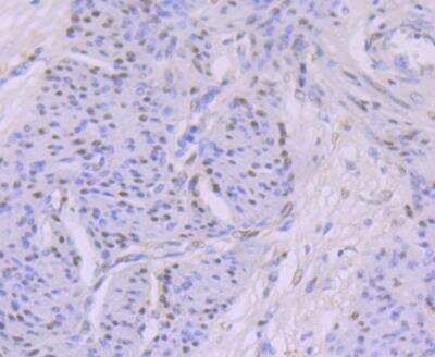 Immunohistochemistry: MYST1 Antibody (JG36-05) [NBP2-76844] - Immunohistochemical analysis of paraffin-embedded human cervix tissue using anti-KAT8 antibody. Counter stained with hematoxylin.