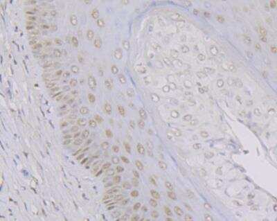 Immunohistochemistry: MYST1 Antibody (JG36-05) [NBP2-76844] - Immunohistochemical analysis of paraffin-embedded rat cervix tissue using anti-KAT8 antibody. Counter stained with hematoxylin.