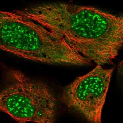 Immunocytochemistry/ Immunofluorescence MYST3 Antibody