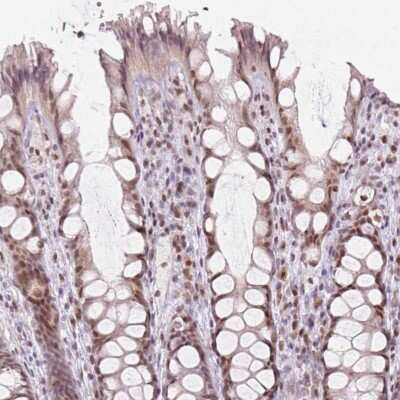 Immunohistochemistry-Paraffin: MYST3 Antibody [NBP2-56972] - Immunohistochemical staining of human colon shows moderate nuclear positivity in glandular cells.