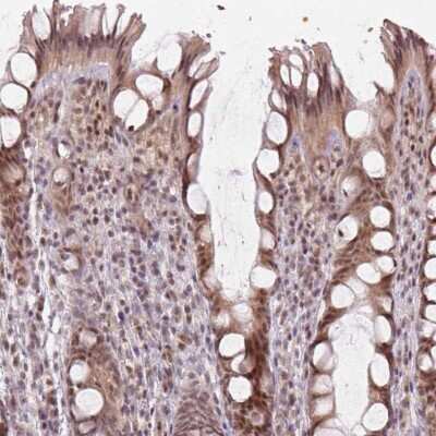 Immunohistochemistry-Paraffin: MYST3 Antibody [NBP2-57745] - Staining of human colon shows moderate nuclear positivity in glandular cells.