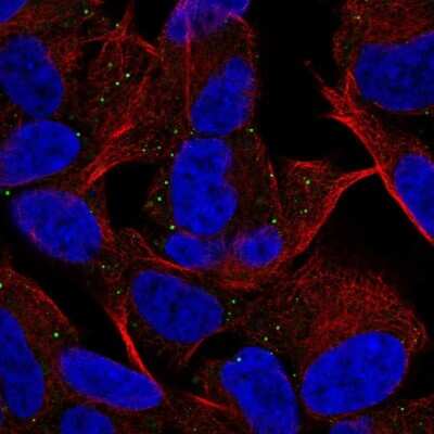 Immunocytochemistry/Immunofluorescence: MYT1L Antibody [NBP2-68757] - Staining of human cell line SH-SY5Y shows localization to vesicles.