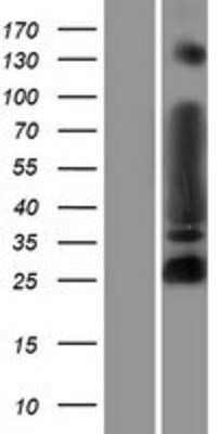 Western Blot: MYT1L Overexpression Lysate (Adult Normal) [NBP2-07219] Left-Empty vector transfected control cell lysate (HEK293 cell lysate); Right -Over-expression Lysate for MYT1L.