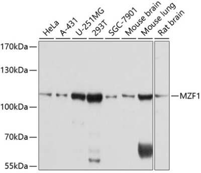 Western Blot: MZF1 Antibody [NBP2-93459] - Analysis of extracts of various cell lines, using MZF1 at 1:1000 dilution.Secondary antibody: HRP Goat Anti-Rabbit IgG (H+L) at 1:10000 dilution.Lysates/proteins: 25ug per lane.Blocking buffer: 3% nonfat dry milk in TBST.Detection: ECL Basic Kit .Exposure time: 3s.