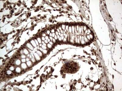 Immunohistochemistry: Macro H2A.2 Antibody (1C2) [NBP2-45930] - Analysis of Human colon tissue. (Heat-induced epitope retrieval by 1 mM EDTA in 10mM Tris, pH8.5, 120C for 3min)