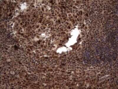 Immunohistochemistry: Macro H2A.2 Antibody (1C2) [NBP2-45930] - Analysis of Human tonsil tissue. (Heat-induced epitope retrieval by 1 mM EDTA in 10mM Tris, pH8.5, 120C for 3min)