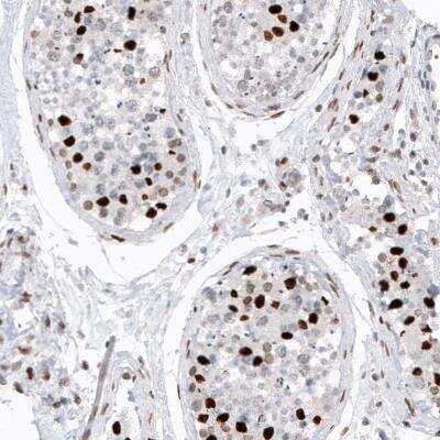 Immunohistochemistry: Macro H2A.2 Antibody (CL5263) [NBP2-61156] - Immunohistochemical staining of human testis shows strong nuclear immunoreactivity in a subset of cells in seminiferous tubules.