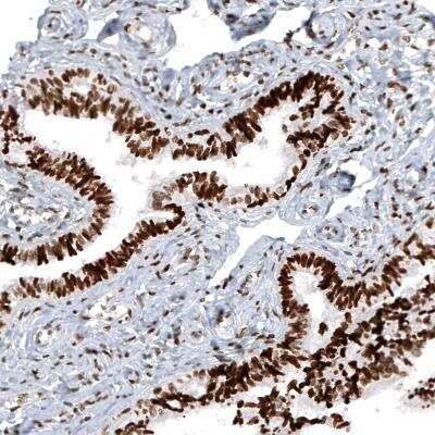 Immunohistochemistry: Macro H2A.2 Antibody (CL5263) [NBP2-61156] - Immunohistochemical staining of human fallopian tube shows strong nuclear immunoreactivity in glandular cells and moderate positivity in stromal cells.