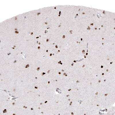 Immunohistochemistry: Macro H2A.2 Antibody (CL5263) [NBP2-61156] - Immunohistochemical staining of human cerebral cortex shows moderate to strong nuclear immunoreactivity in neuronal and glial cells.