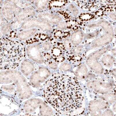 Immunohistochemistry: Macro H2A.2 Antibody (CL5263) [NBP2-61156] - Immunohistochemical staining of human kidney shows strong nuclear positivity in cells in renal glomeruli and a subset of renal tubules.