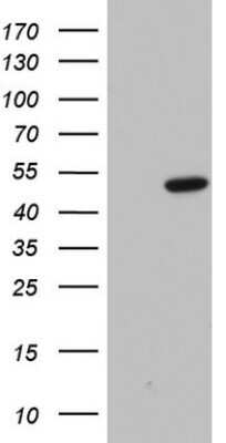 Western Blot: Macro H2A.2 Antibody (OTI1C2) - Azide and BSA Free [NBP2-72564] - Analysis of HEK293T cells were transfected with the pCMV6-ENTRY control (Left lane) or pCMV6-ENTRY H2A.2.
