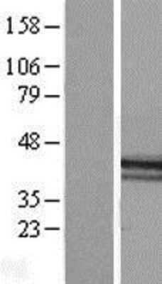 Western Blot: Macro H2A.2 Overexpression Lysate (Adult Normal) [NBL1-11426] Left-Empty vector transfected control cell lysate (HEK293 cell lysate); Right -Over-expression Lysate for Macro H2A.2.