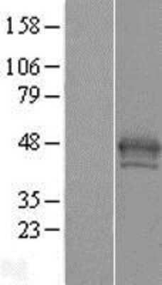 Western Blot: Macro H2A.2 Overexpression Lysate (Adult Normal) [NBP2-10629] Left-Empty vector transfected control cell lysate (HEK293 cell lysate); Right -Over-expression Lysate for Macro H2A.2.