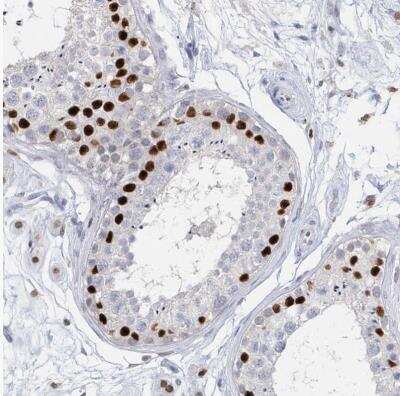 Immunohistochemistry-Paraffin: Macro H2A.2 Antibody [NBP1-92094] - Staining of human testis shows strong nuclear positivity in cells in seminiferous ducts
