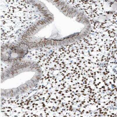Immunohistochemistry-Paraffin: Macro H2A.2 Antibody [NBP1-92094] - Staining of human endometrium shows moderate to strong nuclear positivity in stromal cells.