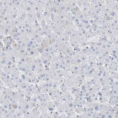 Immunohistochemistry-Paraffin: Macro H2A.2 Antibody [NBP1-92094] - Staining of human liver shows no positivity in hepatocytes as expected.