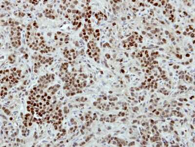 Immunohistochemistry-Paraffin: Macro H2A.2 Antibody [NBP2-17197] - Immunohistochemical analysis of paraffin-embedded TOV-21G xenograft, using antibody at 1:100 dilution.