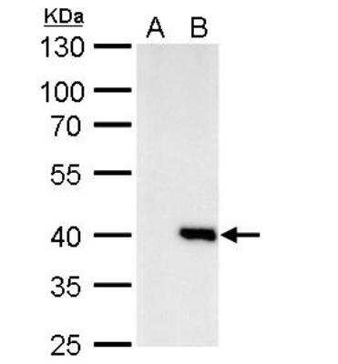 Western Blot: Macro H2A.2 Antibody [NBP2-17196] - A. 30 ug 293T whole cell lysate/extract B. 30 ug whole cell lysate/extract of human H2AFY2-transfected 293T cells 10 % SDS-PAGE Macro H2A.2 antibody dilution: 1:1000