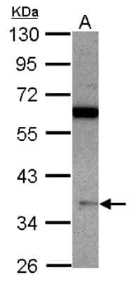 Western Blot: Macro H2A.2 Antibody [NBP2-17197] - Sample (30 ug of whole cell lysate) A: A431 10% SDS PAGE gel, diluted at 1:500.