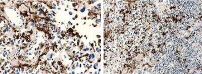 Immunohistochemistry-Paraffin: Macrophage Antibody (RM0029-11H3) [NBP2-12436] - Mouse skin tissue from human breast cancer cell xenograft.