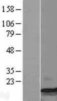 Western Blot: Macrophage Inflammatory Protein 1 beta Overexpression Lysate (Adult Normal) [NBL1-08858] Left-Empty vector transfected control cell lysate (HEK293 cell lysate); Right -Over-expression Lysate for Macrophage Inflammatory Protein 1 beta.