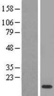 Western Blot: Macrophage Inflammatory Protein 3 Overexpression Lysate (Adult Normal) [NBL1-08853] Left-Empty vector transfected control cell lysate (HEK293 cell lysate); Right -Over-expression Lysate for Macrophage Inflammatory Protein 3.