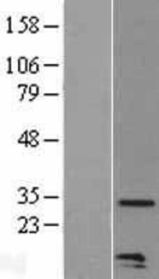 Western Blot CCL20/MIP-3 alpha Overexpression Lysate