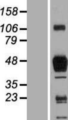 Western Blot SR-AI/MSR Overexpression Lysate