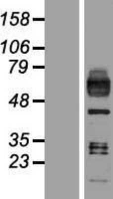Western Blot: Macrophage Scavenger Receptor I Overexpression Lysate (Adult Normal) [NBP2-10831] Left-Empty vector transfected control cell lysate (HEK293 cell lysate); Right -Over-expression Lysate for Macrophage Scavenger Receptor I.