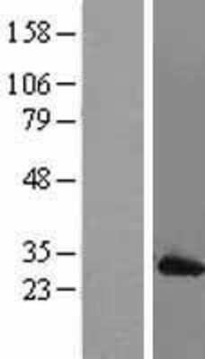 Western Blot: Mad2L1 Overexpression Lysate (Adult Normal) [NBL1-12786] Left-Empty vector transfected control cell lysate (HEK293 cell lysate); Right -Over-expression Lysate for Mad2L1.