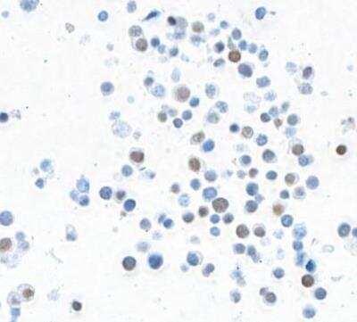 Immunocytochemistry/Immunofluorescence: MafA Antibody (BLR067G) [NBP2-78707] - Rabbit anti-MafA recombinant monoclonal antibody [BLR067G]. Secondary: HRP-conjugated goat anti-rabbit IgG.  Substrate: DAB.