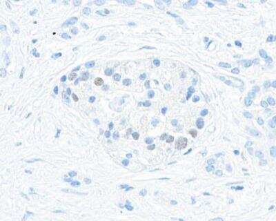 Immunohistochemistry-Paraffin: MafA Antibody (BLR067G) [NBP2-78707] - Rabbit anti-MafA recombinant monoclonal antibody [BLR067G] Secondary: HRP-conjugated goat anti-rabbit IgG.  Substrate: DAB.