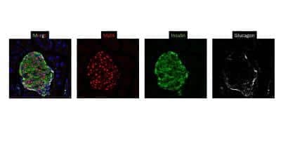 Immunocytochemistry/ Immunofluorescence MafA Antibody