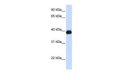 Western Blot: MafA Antibody [NBP3-09248] - Western blot analysis using NBP3-09248 on Human Placenta  as a positive control. Antibody Titration: 0.2-1 ug/ml