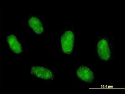 Immunocytochemistry/Immunofluorescence: MafG Antibody [H00004097-B01P] - Analysis of purified antibody to MAFG on Daoy cell. (antibody concentration 10 ug/ml)