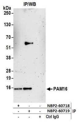 Immunoprecipitation: Magmas Antibody [NBP2-60719] - Detection of immunoprecipitates. Samples: Whole cell lysate (0.5 or 1.0 mg per IP reaction; 20% of IP loaded) from 293T cells prepared using NETN lysis buffer. Antibodies: Affinity purified rabbit anti-PAM16 antibody NBP2-60719 used for IP at 8 ul per reaction. PAM16 was also immunoprecipitated by rabbit anti-PAM16 antibody NBP2-60718. For blotting immunoprecipitated PAM16, NBP2-60719 was used at 1:400. Detection: Chemiluminescence with an exposure time of 3 minutes.