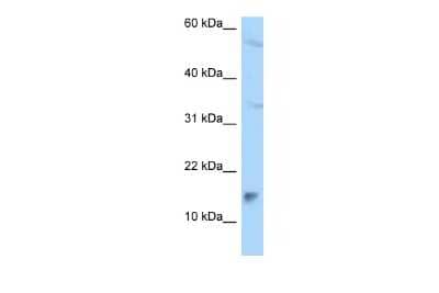 Western Blot: Mago nashi homolog 2 Antibody [NBP2-84153] - WB Suggested Anti-MAGOHB Antibody. Titration: 1.0 ug/ml. Positive Control: A549 Whole Cell