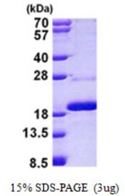 SDS-Page: Mago nashi homolog 2 Protein [NBP2-23209]