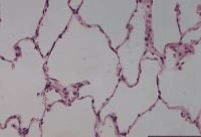 Hematoxylin & Eosin Stain: Main bronchus chronic bronchitis tissue Tissue Slides (Normal) [NBP2-30176] -  bronchus, normal  Age/Sex : 37/F