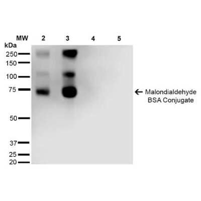 Western Blot: Malondialdehyde Antibody (11E3) [NBP2-59367] - Western Blot analysis of Malondialdehyde-BSA Conjugate showing detection of 67 kDa Malondialdehyde protein using Mouse Anti-Malondialdehyde Monoclonal Antibody, Clone 11E3 (NBP2-59367). Lane 1: Molecular Weight Ladder (MW). Lane 2: Malondialdehyde-BSA (0.5 ug). Lane 3: Malondialdehyde-BSA (2.0 ug). Lane 4: BSA (0.5 ug). Lane 5: BSA (2.0 ug) . Block: 5% Skim Milk in TBST. Primary Antibody: Mouse Anti-Malondialdehyde Monoclonal Antibody (NBP2-59367) at 1:1000 for 2 hours at RT. Secondary Antibody: Goat Anti-Mouse IgG: HRP at 1:2000 for 60 min at RT. Color Development: ECL solution for 5 min in RT. Predicted/Observed Size: 67 kDa.