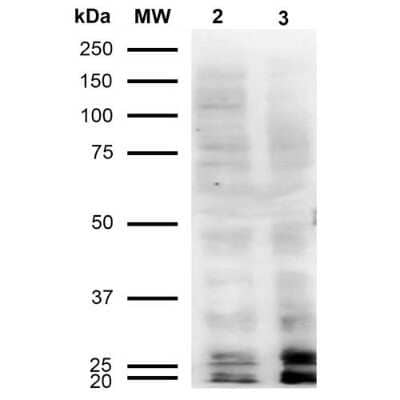 Western Blot: Malondialdehyde Antibody (11E3) [NBP2-59367] - Western Blot analysis of Human Cervical cancer cell line (HeLa) lysate showing detection of Malondialdehyde protein using Mouse Anti-Malondialdehyde Monoclonal Antibody, Clone 11E3 (NBP2-59367). Lane 1: Molecular Weight Ladder (MW). Lane 2: HeLa cell lysate. Lane 3: H2O2 treated HeLa cell lysate. Load: 12 ug. Block: 5% Skim Milk in TBST. Primary Antibody: Mouse Anti-Malondialdehyde Monoclonal Antibody (NBP2-59367) at 1:1000 for 2 hours at RT. Secondary Antibody: Goat Anti-Mouse IgG: HRP at 1:2000 for 60 min at RT. Color Development: ECL solution for 5 min in RT.