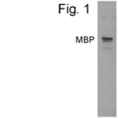 Western Blot: Maltose Binding Protein Antibody [NBP2-22462] - Analysis of maltose binding fusion protein.