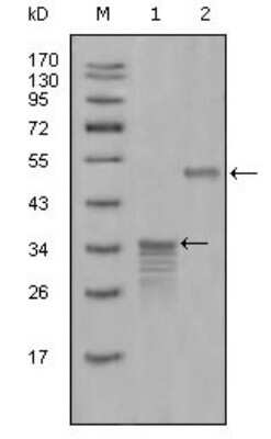 Western Blot: Mammaglobin A Antibody (1G8D6) [NBP1-28876] - Western blot analysis using Mammaglobin-1 mouse mAb against full-length GST- Mammaglobin-A (1) and full-length MBP- Mammaglobin-A recombinant protein (2).