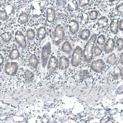 Immunohistochemistry-Paraffin: Mammaglobin A Antibody (CL8892) [NBP3-05504] - Staining of human duodenum shows no positivity in glandular cells as expected.