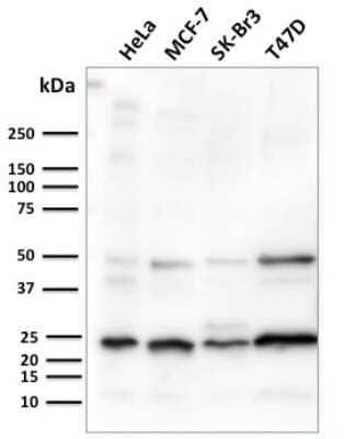 Western Blot: Mammaglobin A Antibody (MGB/2682R) - Azide and BSA Free [NBP3-08525] - Western blot analysis of human HeLa, MCF-7, SK-Br3 & T47D cell lysates using Mammaglobin A Recombinant Rabbit Monoclonal Antibody (MGB/2682R).