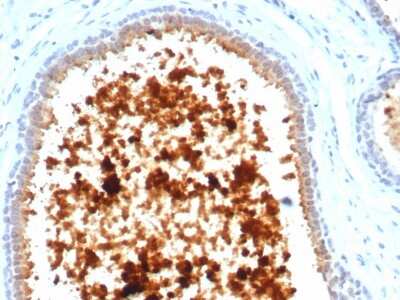 Immunohistochemistry-Paraffin: Mammaglobin A Antibody (MGB/4811R) - Azide and BSA Free [NBP3-08488] - Formalin-fixed, paraffin-embedded human lactating breast stained with Mammaglobin A Recombinant Rabbit Monoclonal Antibody (MGB/4811R).