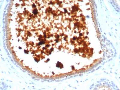 Immunohistochemistry-Paraffin: Mammaglobin A Antibody (MGB/4811R) - Azide and BSA Free [NBP3-08488] - Formalin-fixed, paraffin-embedded human lactating breast stained with Mammaglobin A Recombinant Rabbit Monoclonal Antibody (MGB/4811R).