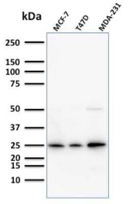 Western Blot: Mammaglobin A Antibody (SPM518) - Azide and BSA Free [NBP2-79864] - Western Blot Analysis of Human MCF-7,T47D and MDA-231 cell lysate using Monospecific Mouse Monoclonal Antibody (SPM518) to Mammaglobin.