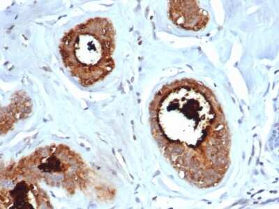 Immunohistochemistry-Paraffin: Mammaglobin A Antibody (rMGB/6619) - Azide and BSA Free [NBP3-08428] - Formalin-fixed, paraffin-embedded human lactating breast stained with Mammaglobin A Recombinant Mouse Monoclonal Antibody (rMGB/6619).