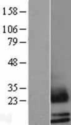 Western Blot: Mammaglobin B Overexpression Lysate (Adult Normal) [NBL1-15734] Left-Empty vector transfected control cell lysate (HEK293 cell lysate); Right -Over-expression Lysate for Mammaglobin B.